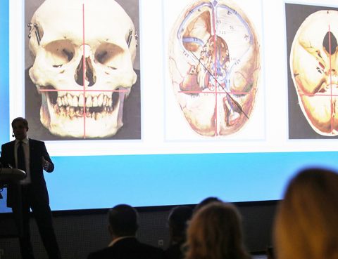 Patirtis dantų implantacijoje